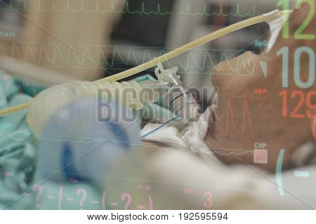 Patient Do Tracheostomy And Ventilator In Hospital