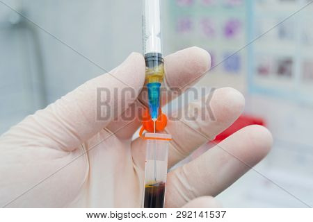 Scientist Holding In His Hand A Centrifuged Blood Sample With Hemolysis