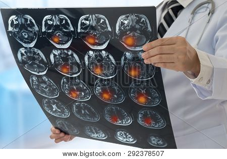 Brain Tumor. Doctor Image & Photo (Free Trial) | Bigstock