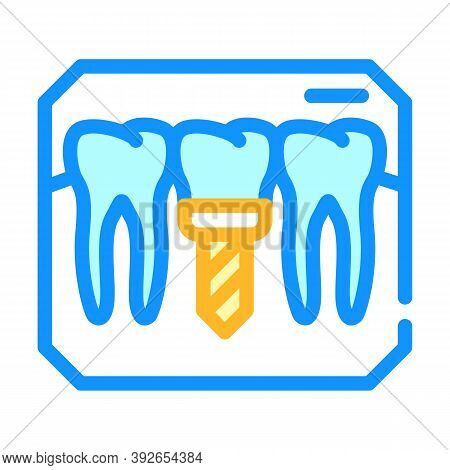 Implant Check Color Icon Vector Illustration Sign