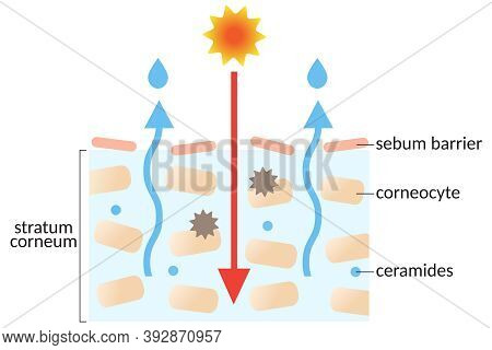 Dry Skin Layer With Stratum Corneum And Ceramides. Illustration. Beauty And Skin Care Concept
