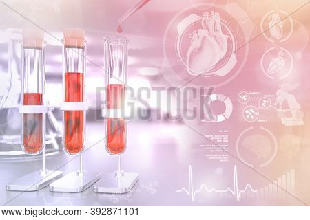 Test-tubes In Chemical Facility - Blood Gene Test For Red Cell Distribution Or Triglycerides, Medica