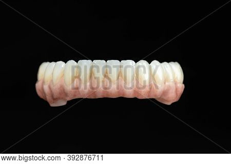 Dental Health Care. Ceramic Zirconium In Final Version. Close Up Dental Prosthesis On Zirconium Oxid