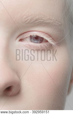 Nose And Eyelid. Close Up Portrait Of Beautiful Albino Female Model. Parts Of Face And Body. Beauty,