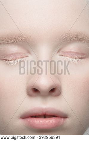 Eyes Closed. Close Up Portrait Of Beautiful Albino Female Model. Parts Of Face And Body. Beauty, Fas