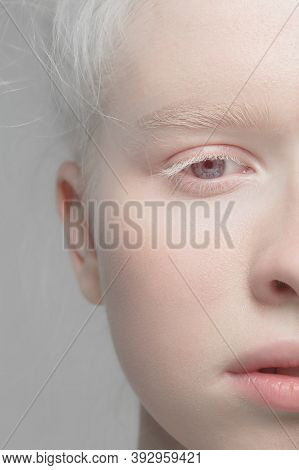 Eyes Open. Close Up Portrait Of Beautiful Albino Female Model. Parts Of Face And Body. Beauty, Fashi