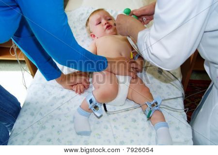 electrocardiogram