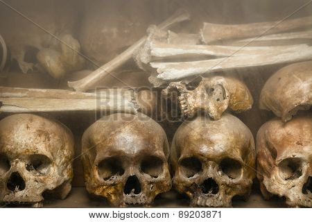 Human Bones