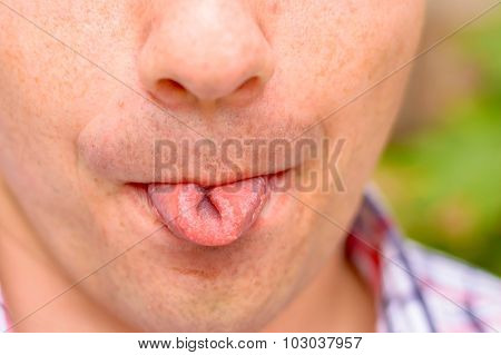 Tongue Rolling Or Curly Tongue