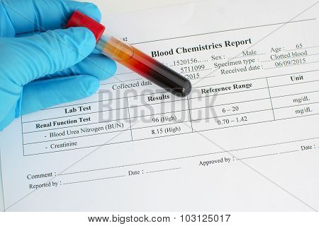 Abnormal renal function test result