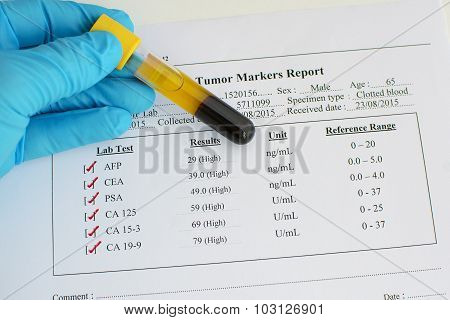 Abnormal tumor marker results