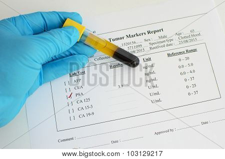 PSA testing result: Normal