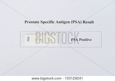 PSA result positive
