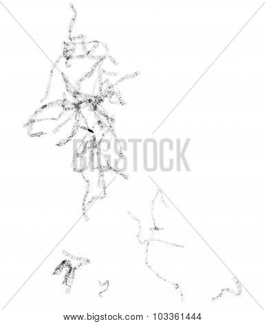 Black And White Spirogyra Micrograph