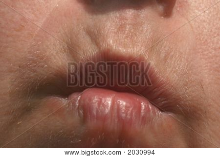 Uønskede Facial Hair