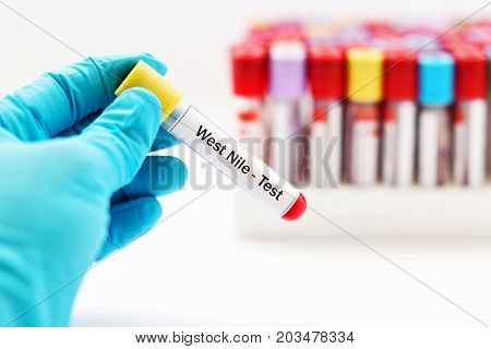 Blood sample for West Nile virus test
