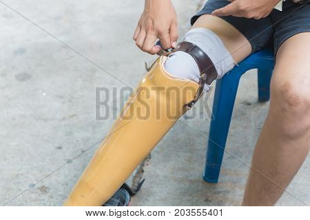 New Aluminium Prostheses Legs For Amputee Patient