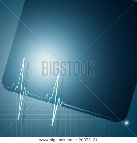 벡터 하트 비트 그래프