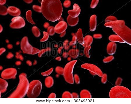 3d rendered medically accurate illustration of sickle cells