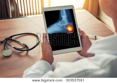 Doctor Holding A Digital Tablet With X-ray With Pain On The Heel Of The Foot.