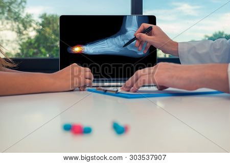 Doctor Showing A X-ray Of A Foot With Pain On The Toes On A Laptop To A Woman Patient.