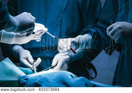 Concentrated Professional Surgical Doctor Team Operating Surgery A Patient In The Operating Room At 