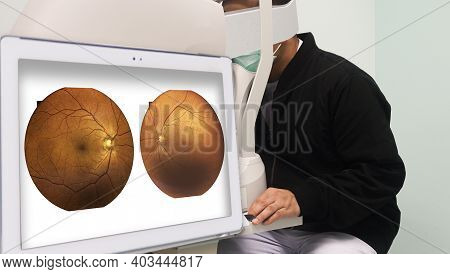 Out Of Focus Patients Are Examining Their Eyesight With A Optical Coherence Tomography In A Screenin