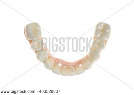 Dental Health Care. Ceramic Zirconium In Final Version From Above. Close Up Dental Prosthesis On Zir