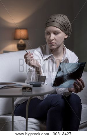 Businesswoman With Brain Tumor