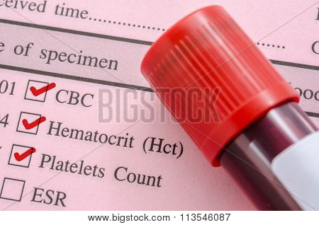 Cbc, Hemotocrit, Platelets Count With Request Screening Test