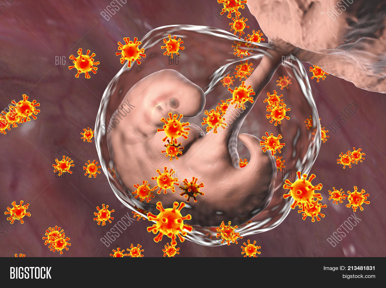 Perinatal Transmission Image & Photo (Free Trial) Bigstock