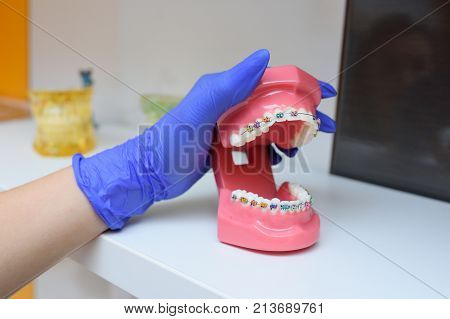 colored braces on teeth on an artificially jawed closeup