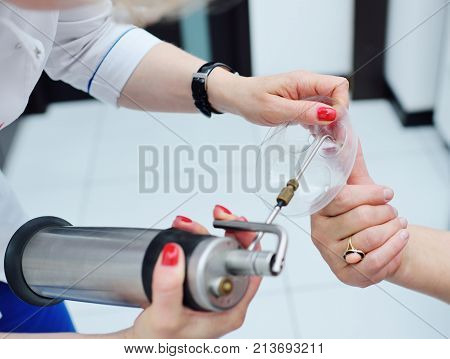 The dermatologist removes the wart on the patient's finger using a special device - a cryodestructor