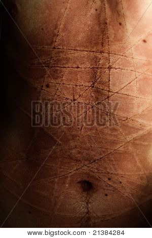 Male Abdomen With Scars From Cuts