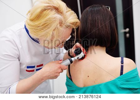 Doctor examining birthmarks and moles patient. examination of birthmarks and moles.the doctor examines the patient's mole
