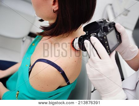 Doctor examining birthmarks and moles patient. examination of birthmarks and moles.the doctor examines the patient's mole