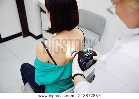 Doctor examining birthmarks and moles patient. examination of birthmarks and moles.the doctor examines the patient's mole
