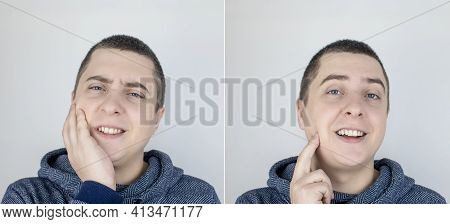 Before And After. On The Left, The Man Indicates Teeth Pain, And On The Right, Indicates That The Te