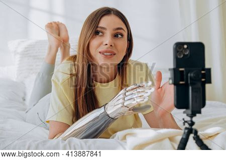 Female Blogger With A Bionic Prosthetic Arm Leads An Online Broadcast Or Records An Issue Or Communi