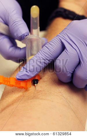 Genuine photos of a Phlebotomist aka Nurse, Doctor, or Trained Medical Professional taking Real Blood samples for analysis from a patient. Photos taken by the Patient while its happening.  
