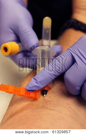 Genuine photos of a Phlebotomist aka Nurse, Doctor, or Trained Medical Professional taking Real Blood samples for analysis from a patient. Photos taken by the Patient while its happening.  