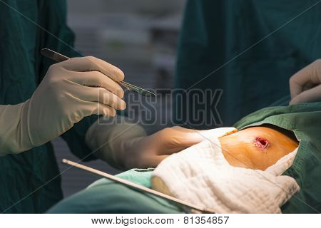 Surgeon Prepare For Skin Incision