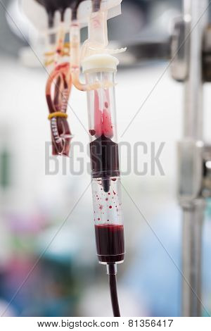 Giving Packed Red Cell Blood During Surgery