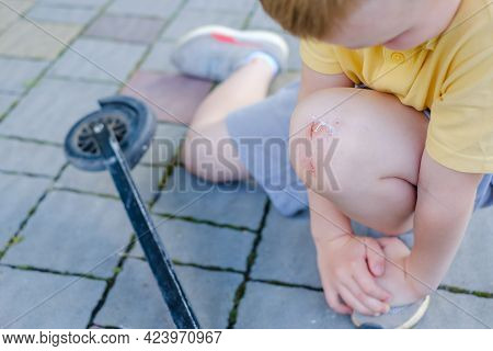 Boy Hurt After Falling Off His Scooter. Childrens Knee Injuries. Beaten Knees On An Asphalt Road.