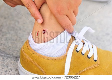 sports injury
