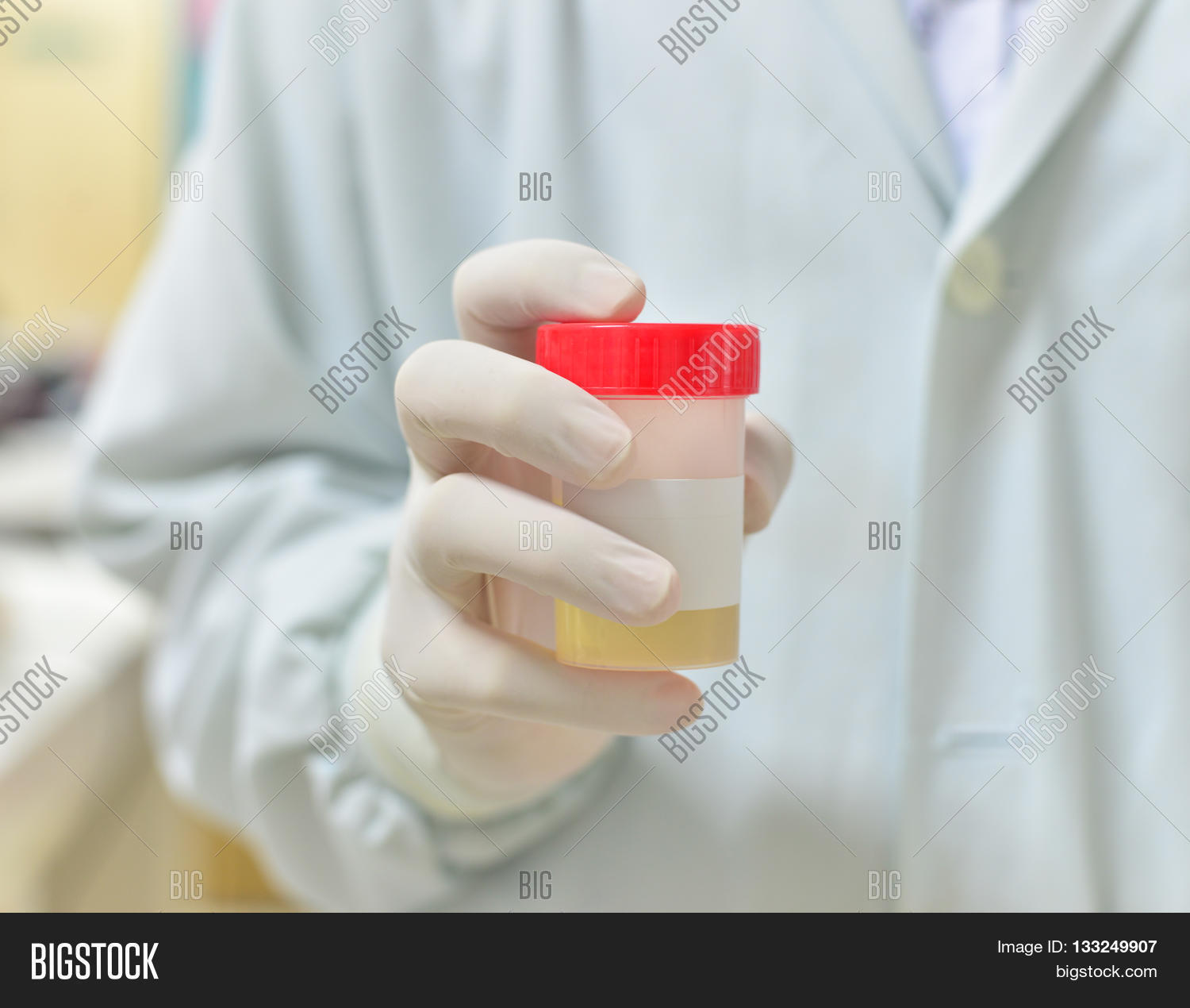 Urine Sample Bottle Image & Photo (Free Trial) Bigstock