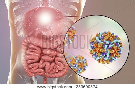 Liver With Hepatitis B Infection And Close-up View Of Hepatitis B Viruses, Medical Concept, 3d Illus