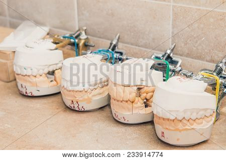 Close Up Few Dental Gypsum Models, Teeth Molds. Plaster Cast Stomatologic Human Jaws Prothetic Labor