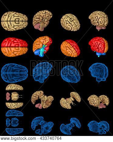 Set Of Isolated Brain Renders - Whole And Split With Rontgen Style Image And Different Colored Funct