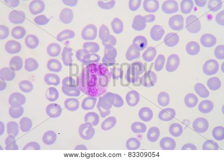 Neutrophils Are A Type Of Phagocyte And Are Normally Found In The Bloodstream. During The Beginning